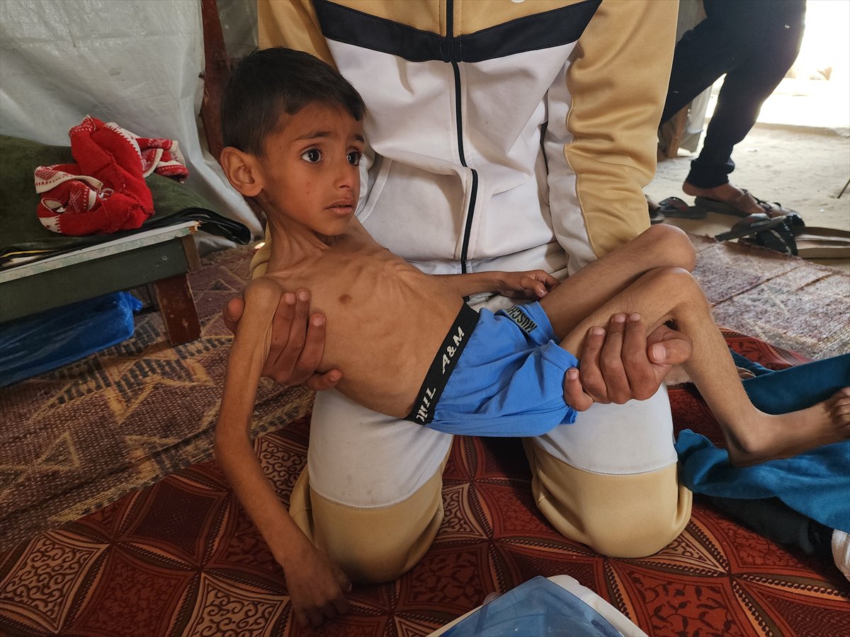 Gazze'de küçük Osama yaşam savaşı veriyor