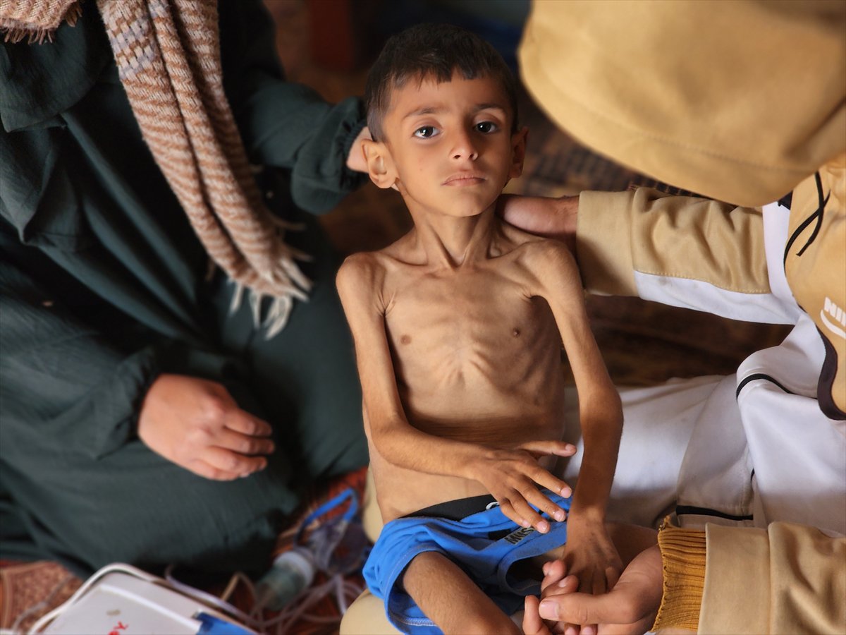 Gazze'de küçük Osama yaşam savaşı veriyor