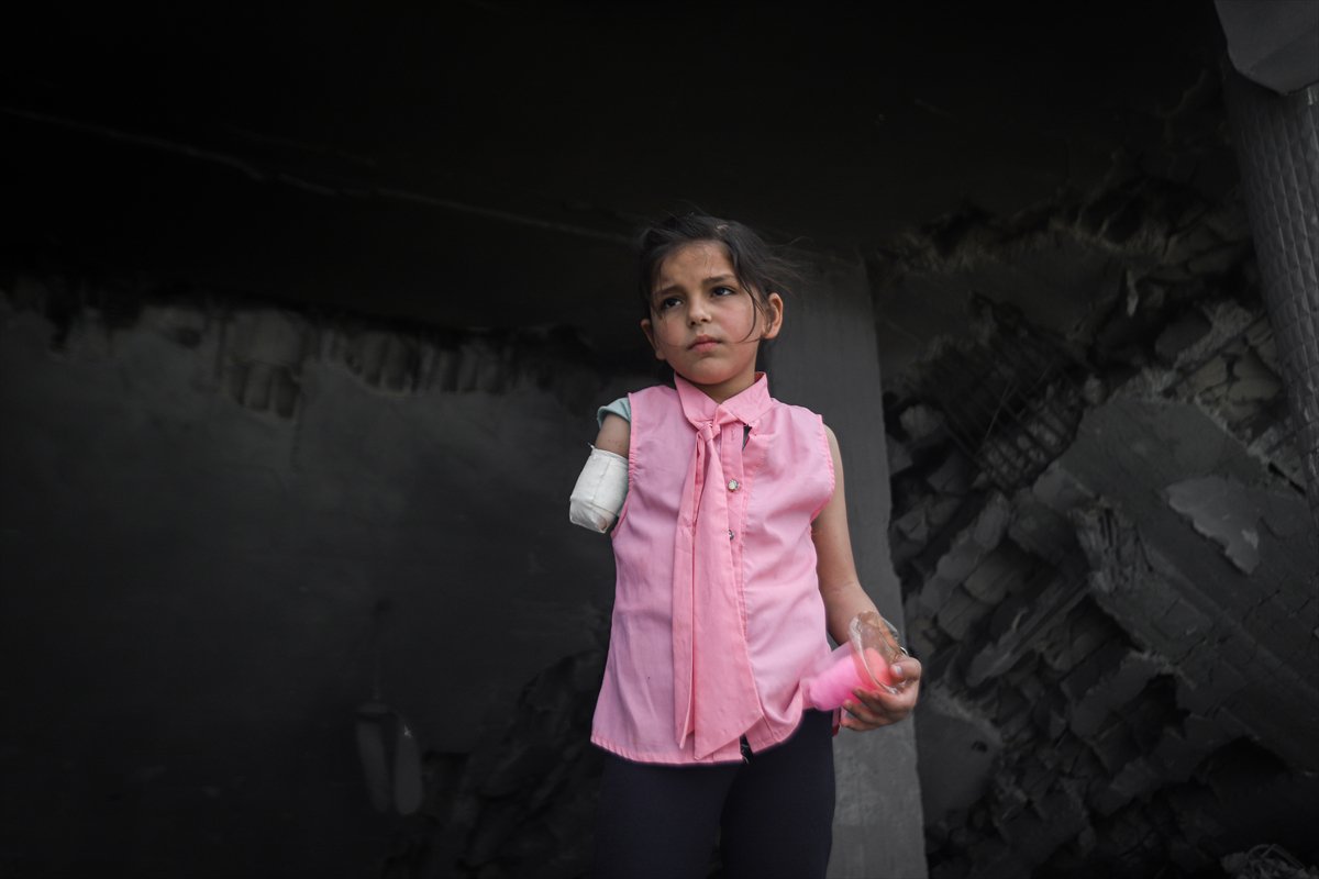 İsrail saldırıları sonrası hayatta kalma mücadelesi: Gade Debabeş’in umut dolu hikayesi