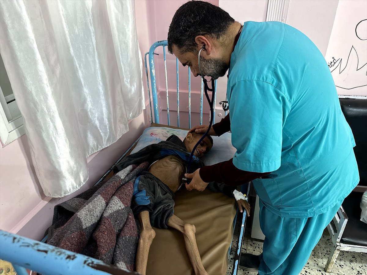 Gazze'de çocukların yetersiz beslenme vakaları giderek artıyor