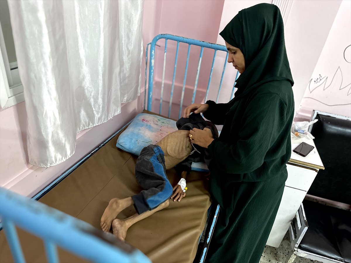 Gazze'de çocukların yetersiz beslenme vakaları giderek artıyor