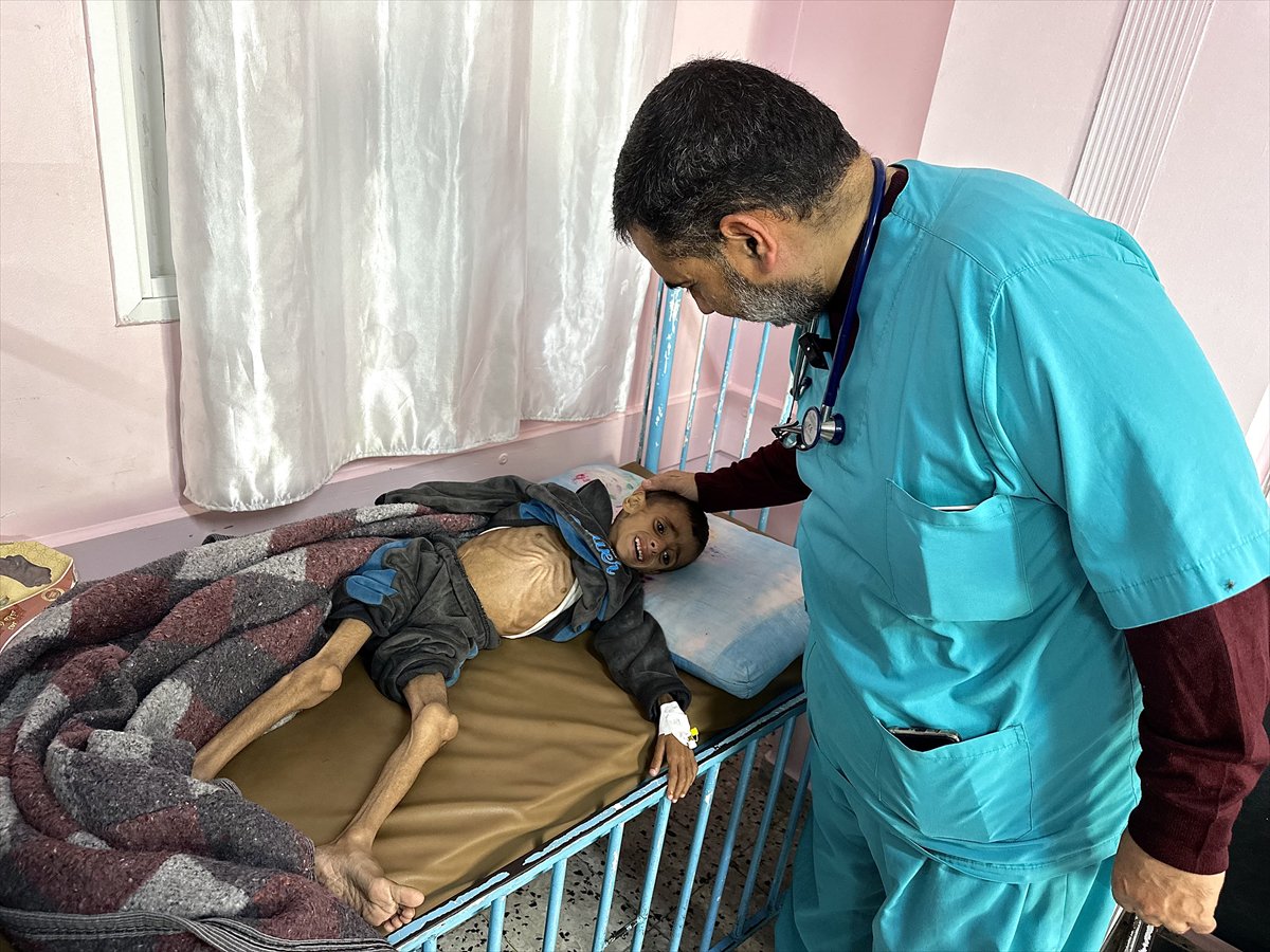 Gazze'de çocukların yetersiz beslenme vakaları giderek artıyor