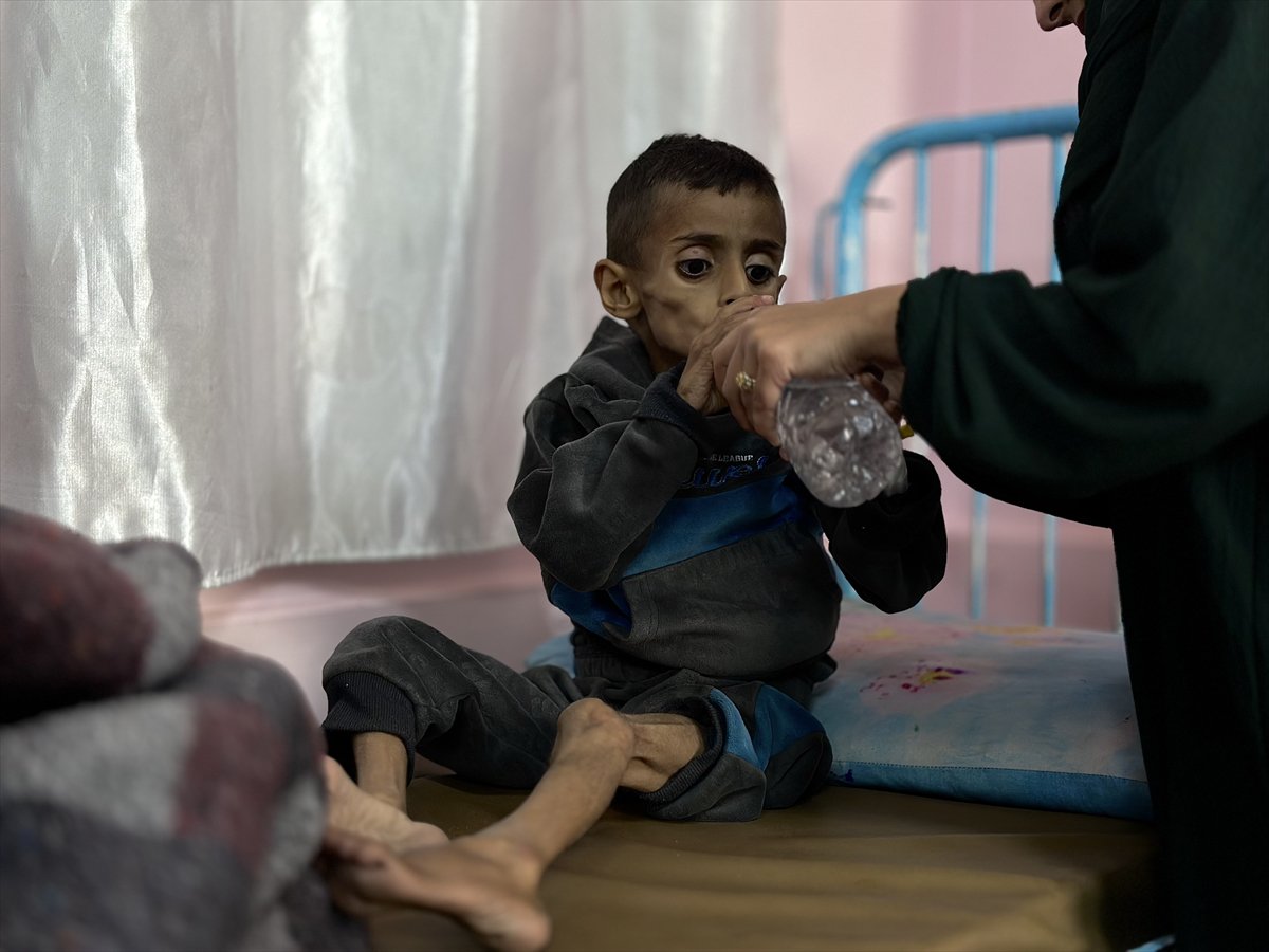 Gazze'de çocukların yetersiz beslenme vakaları giderek artıyor