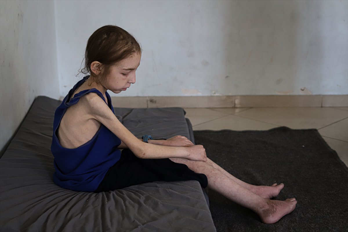 Gazze’de çocuklar, yetersiz beslenme nedeniyle hayatta kalma mücadelesi veriyor