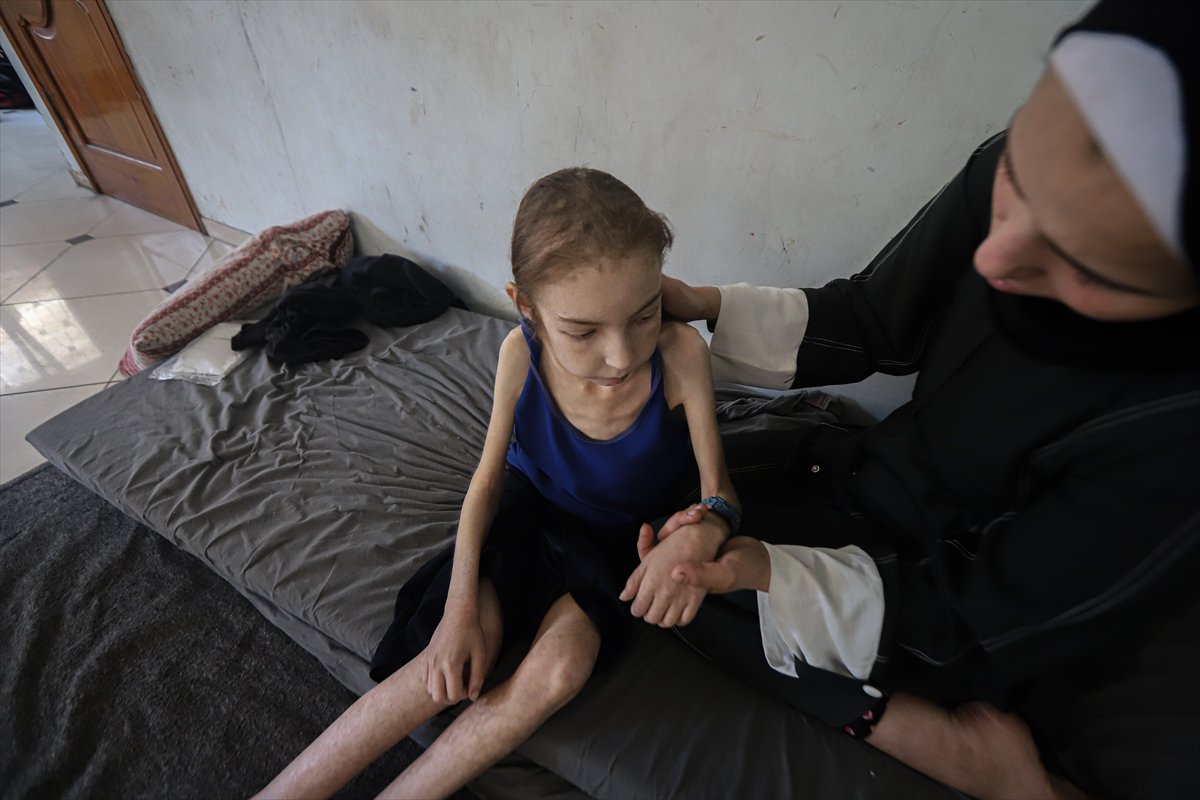 Gazze’de çocuklar, yetersiz beslenme nedeniyle hayatta kalma mücadelesi veriyor