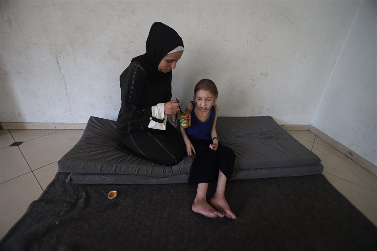 Gazze’de çocuklar, yetersiz beslenme nedeniyle hayatta kalma mücadelesi veriyor