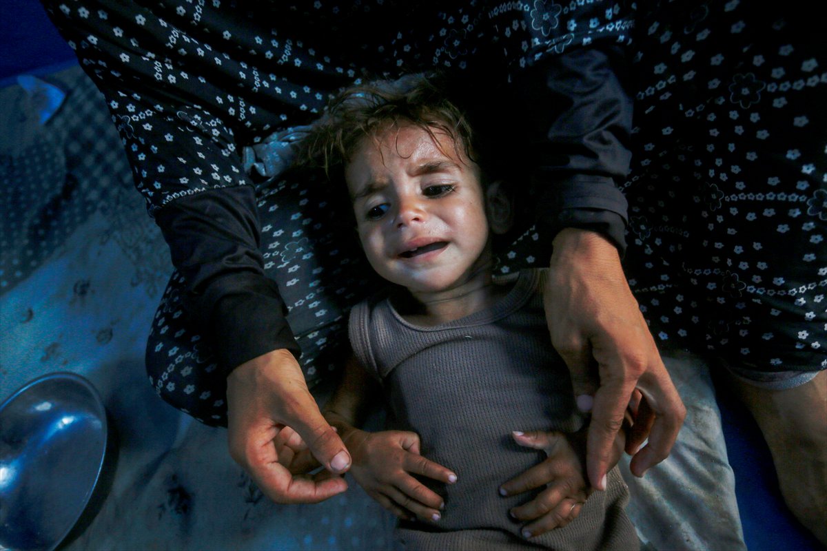 Gazze'de bebekler beslenme sıkıntısı yaşıyor