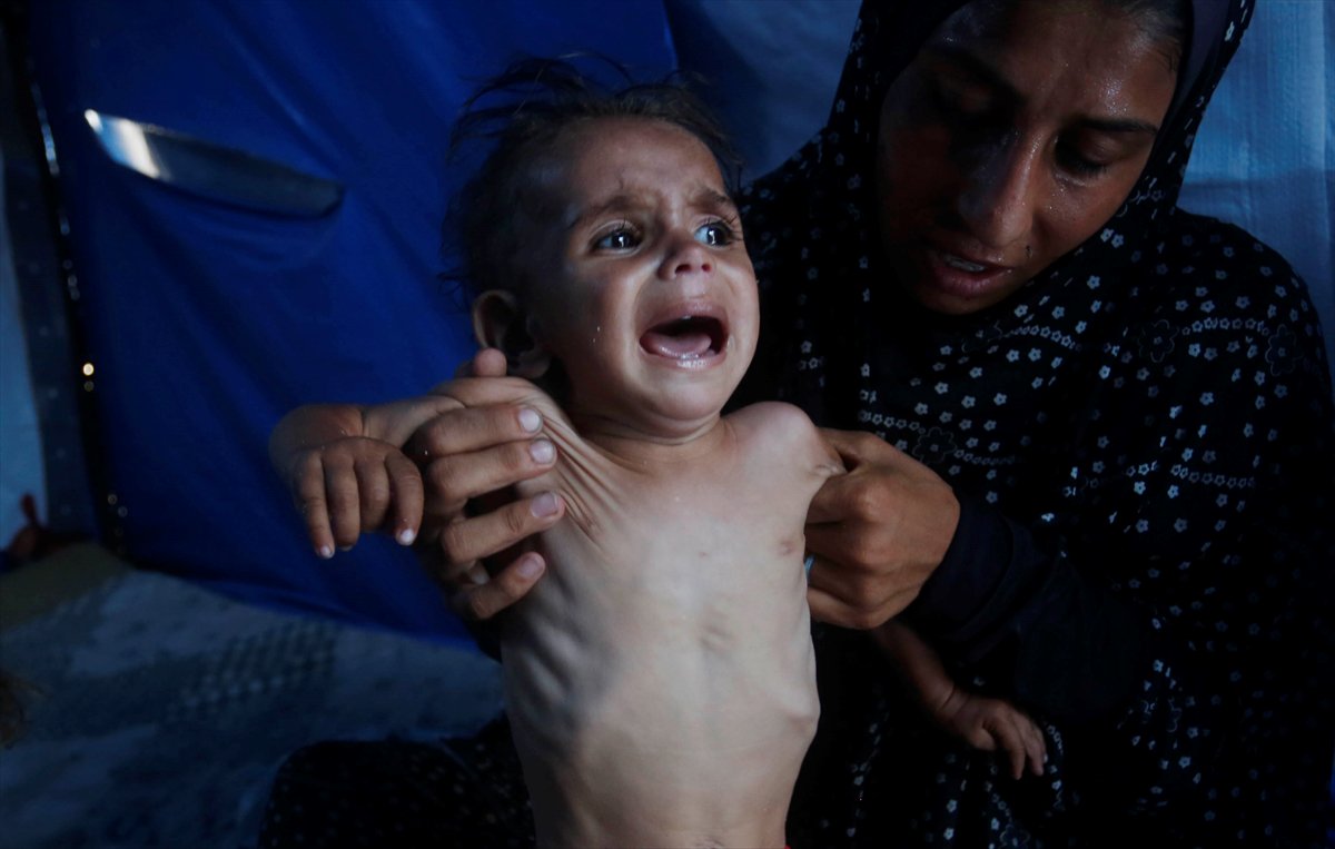 Gazze'de bebekler beslenme sıkıntısı yaşıyor