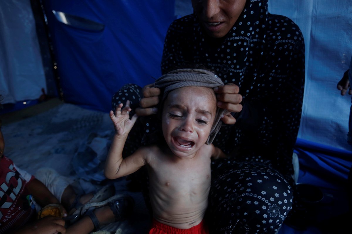 Gazze'de bebekler beslenme sıkıntısı yaşıyor