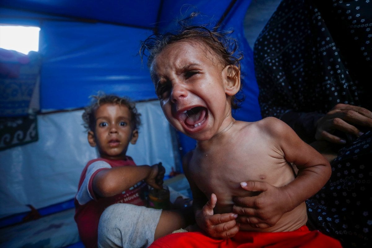 Gazze'de bebekler beslenme sıkıntısı yaşıyor