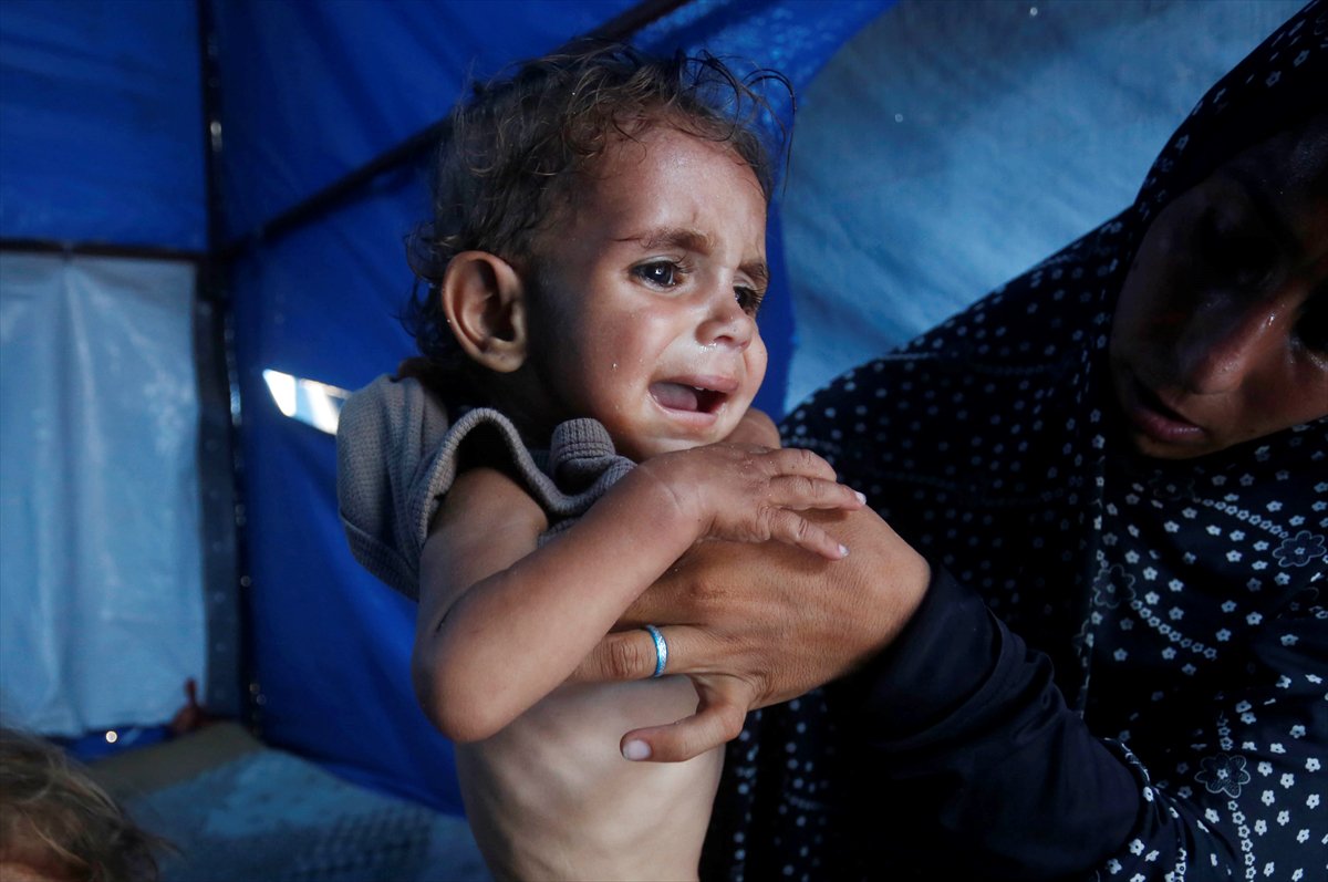 Gazze'de bebekler beslenme sıkıntısı yaşıyor