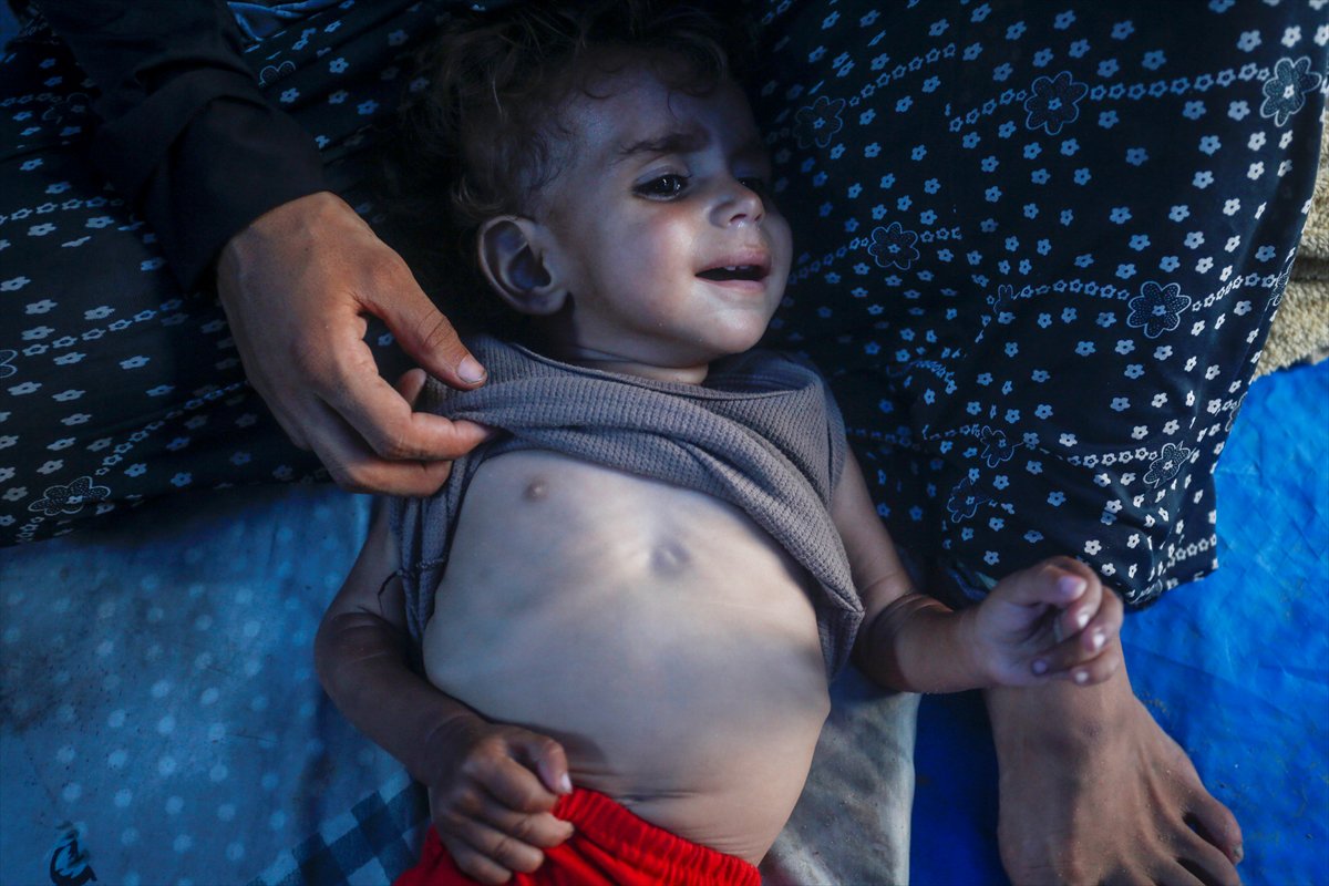 Gazze'de bebekler beslenme sıkıntısı yaşıyor