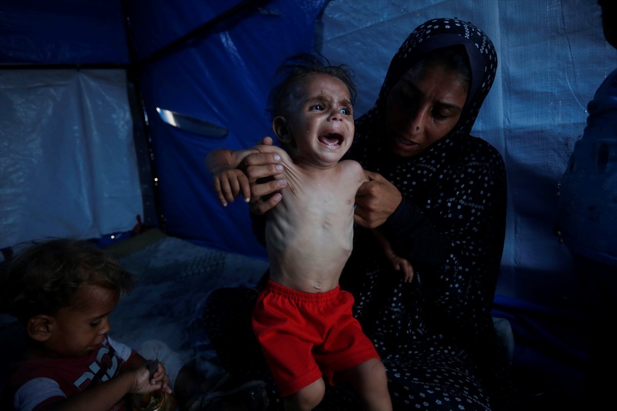 Gazze'de bebekler beslenme sıkıntısı yaşıyor