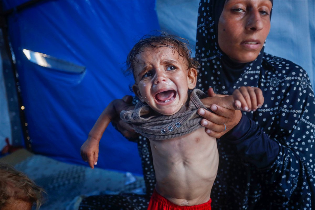 Gazze'de bebekler beslenme sıkıntısı yaşıyor