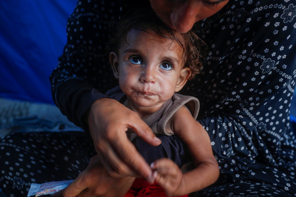 Gazze'de bebekler beslenme sıkıntısı yaşıyor