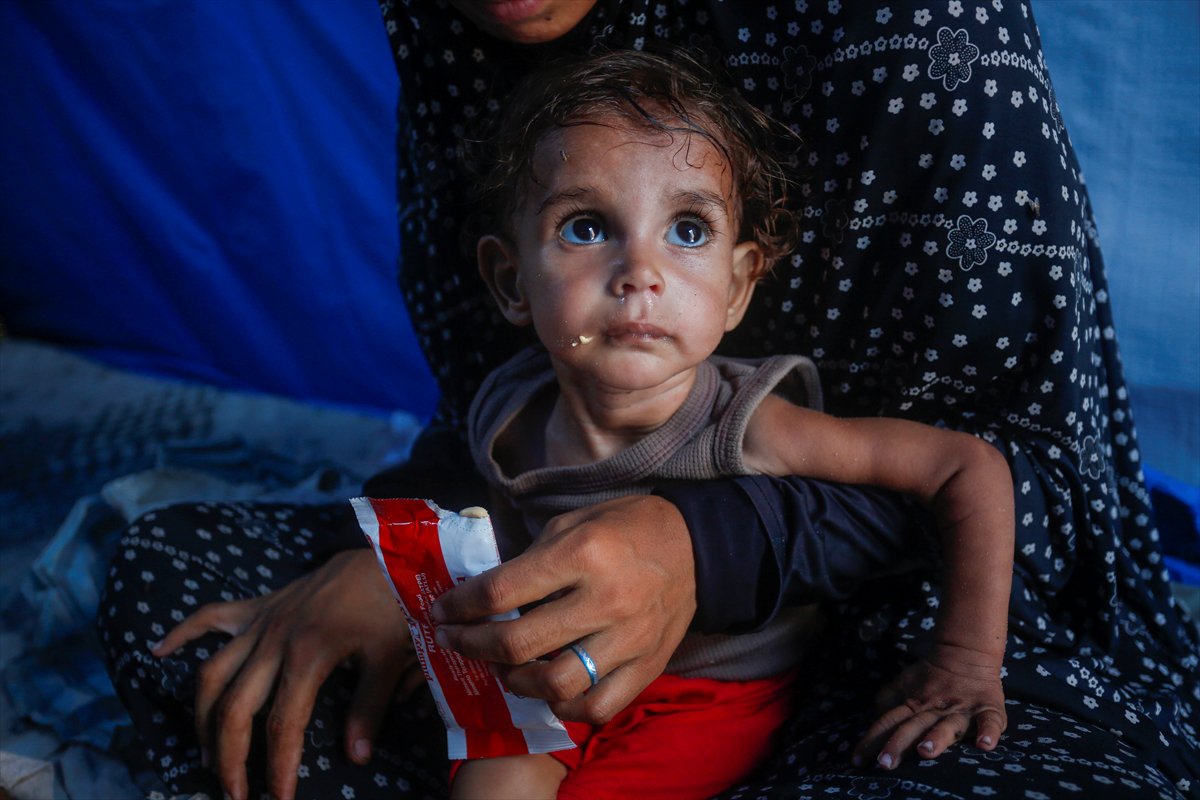 Gazze'de bebekler beslenme sıkıntısı yaşıyor