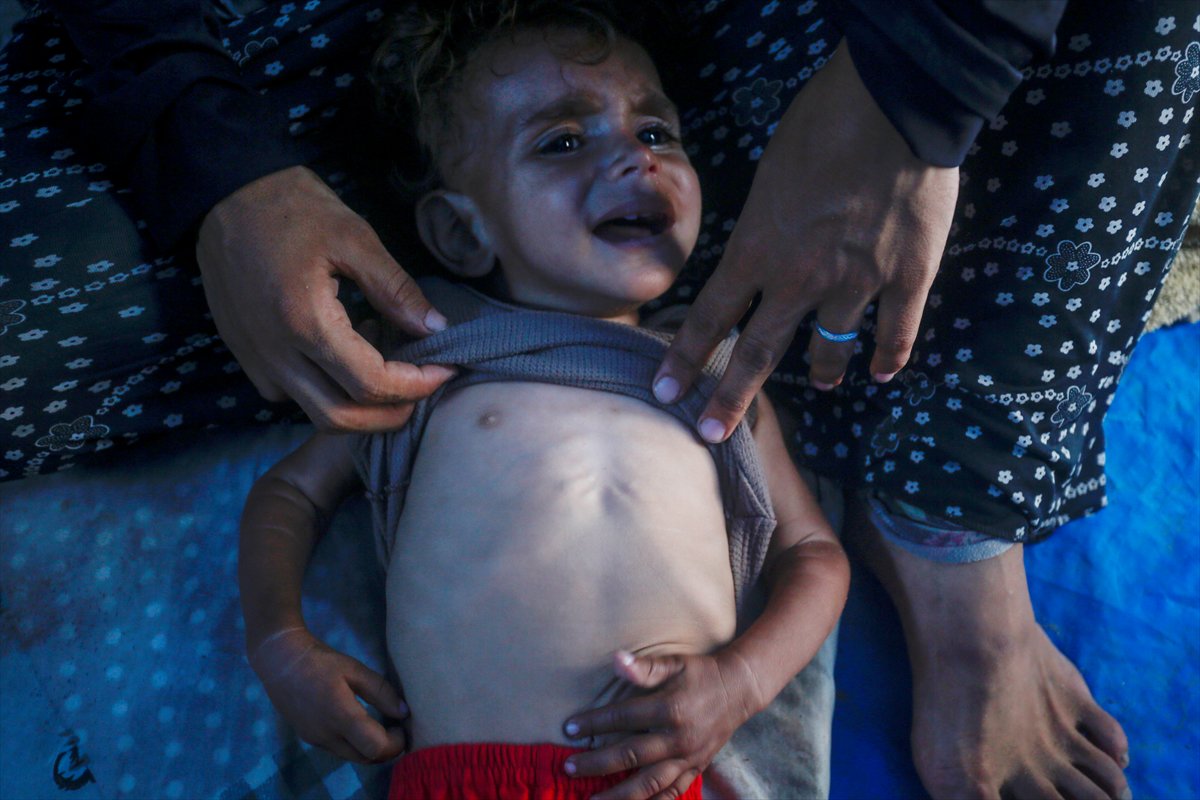 Gazze'de bebekler beslenme sıkıntısı yaşıyor