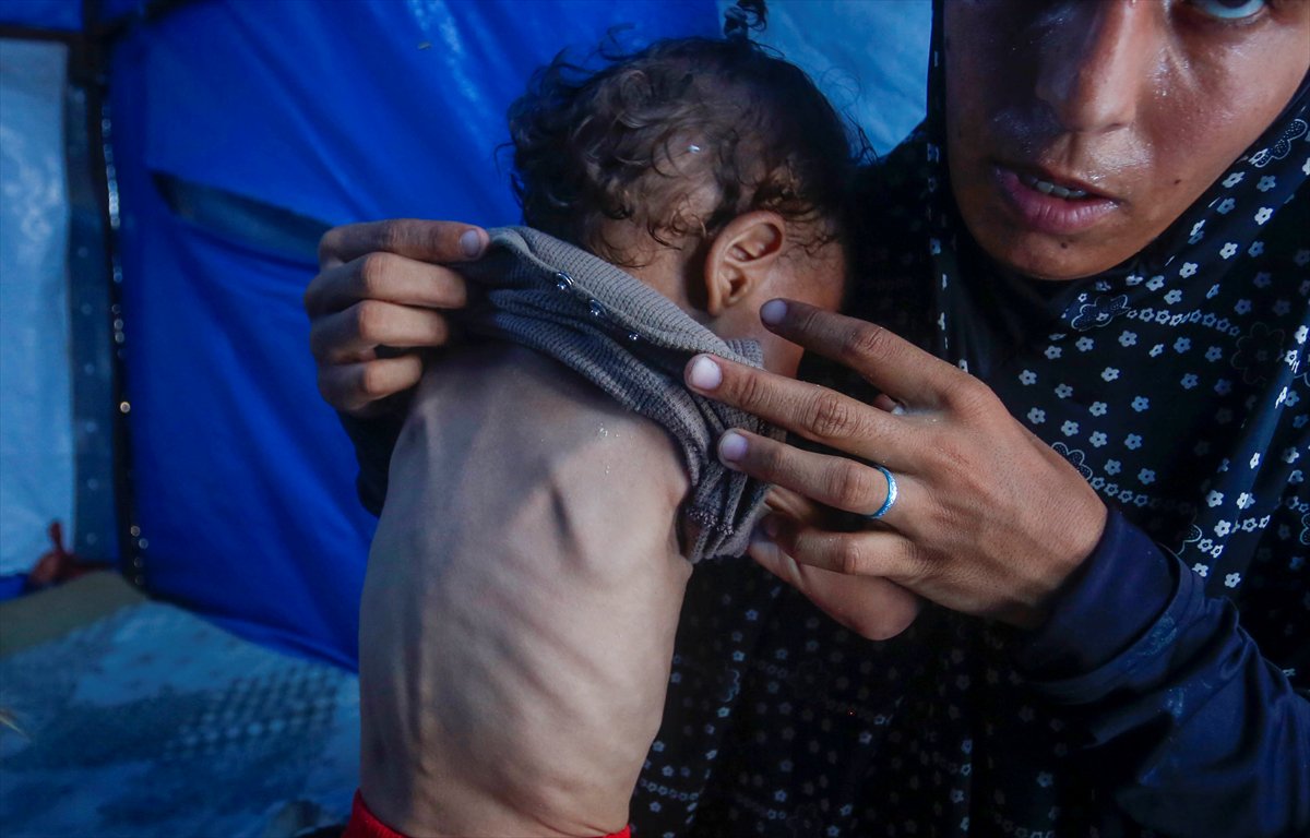 Gazze'de bebekler beslenme sıkıntısı yaşıyor