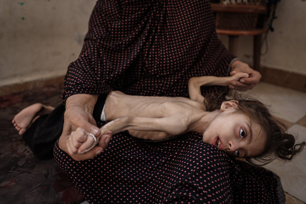 Gazze'de çocukların açlıkla imtihanı