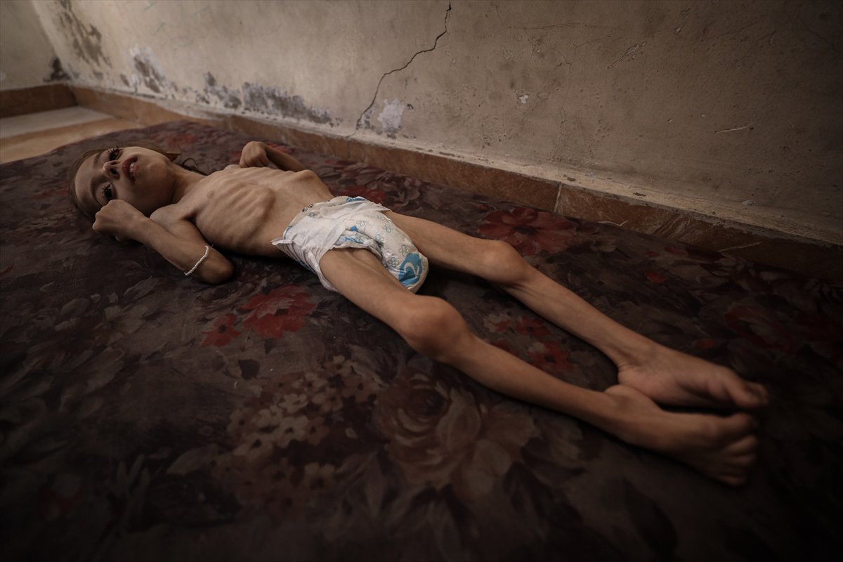 Gazze'de çocukların açlıkla imtihanı