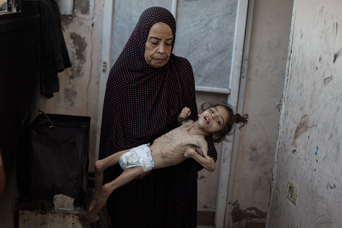 Gazze'de çocukların açlıkla imtihanı