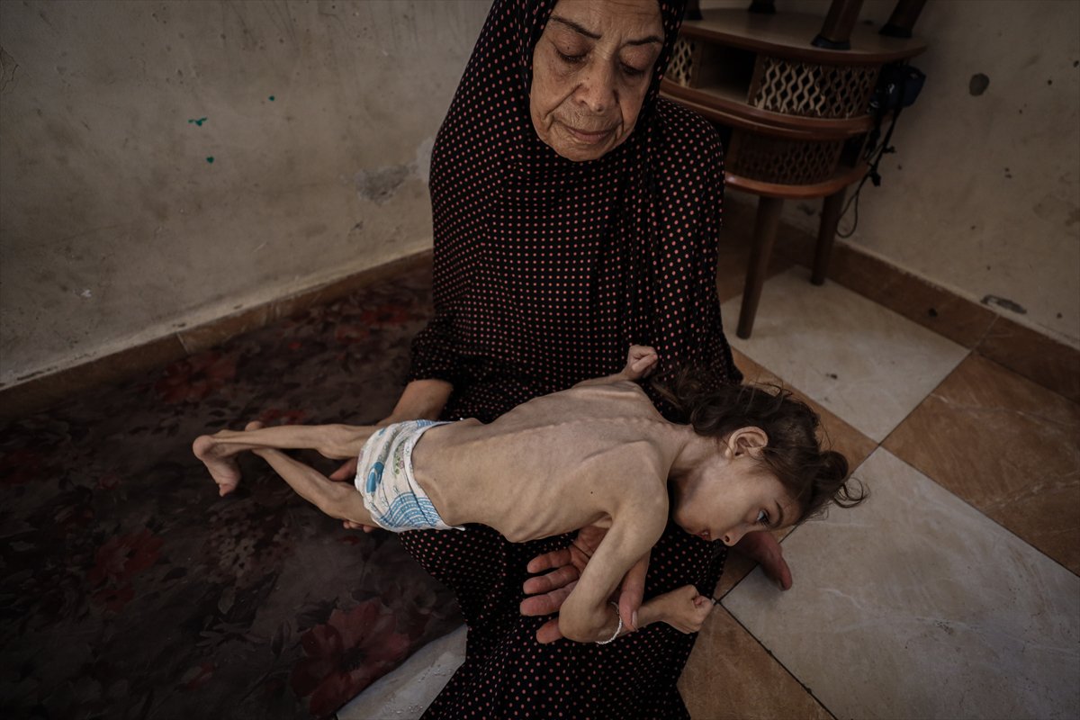 Gazze'de çocukların açlıkla imtihanı