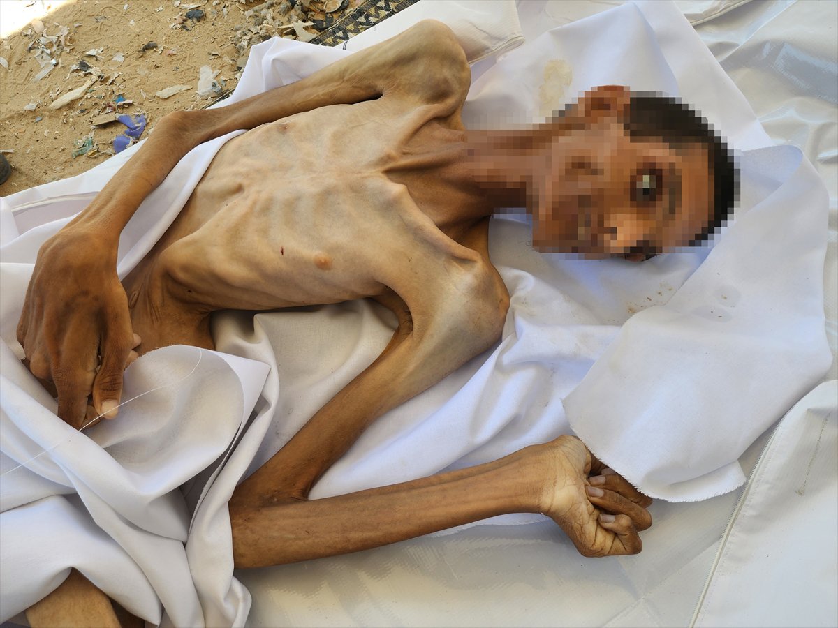 Gazze'de çocukların açlıkla imtihanı