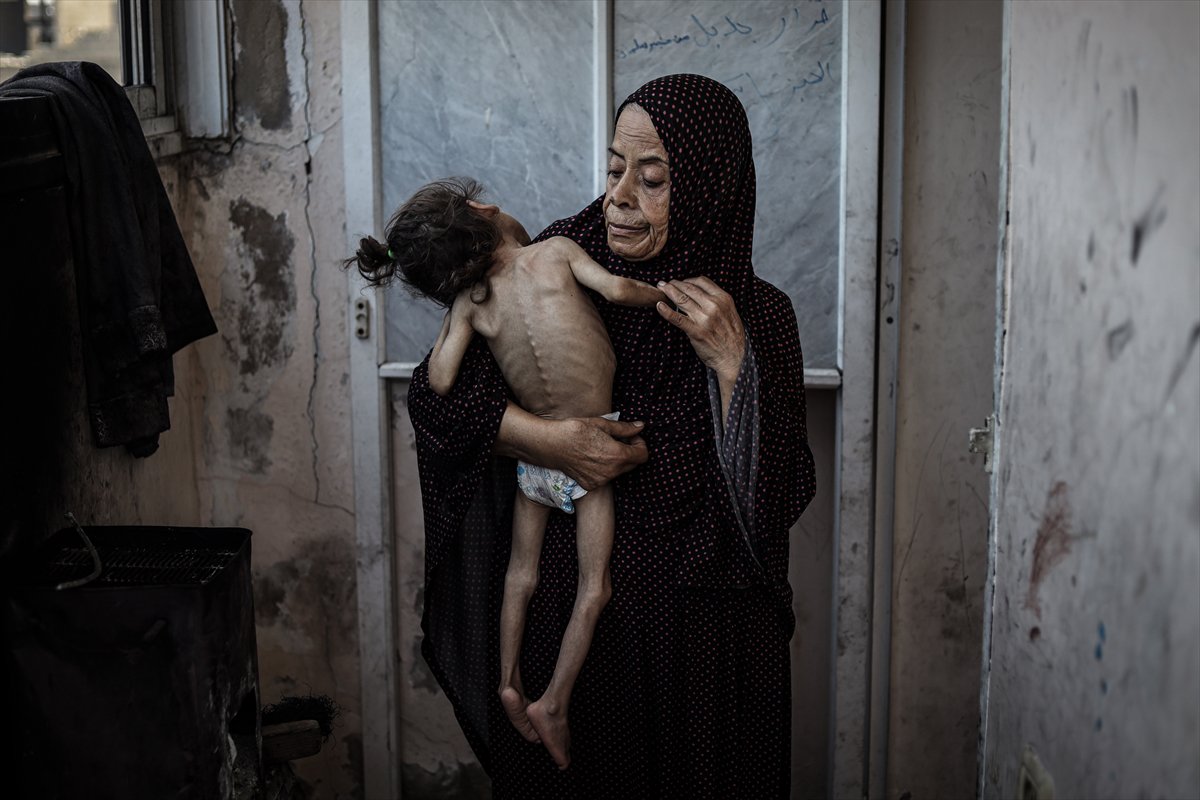 Gazze'de çocukların açlıkla imtihanı