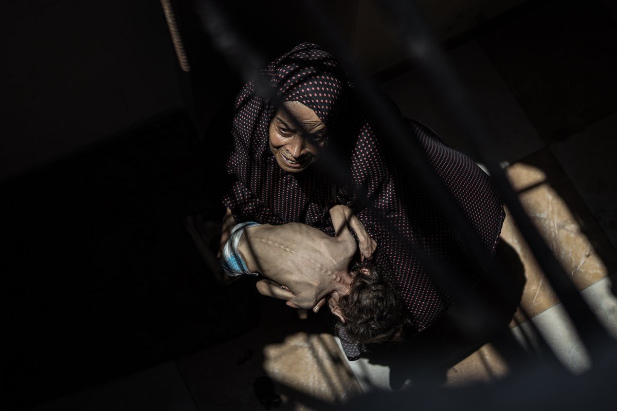 Gazze'de çocukların açlıkla imtihanı