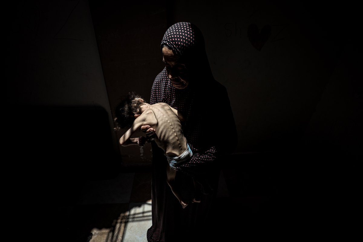 Gazze'de çocukların açlıkla imtihanı