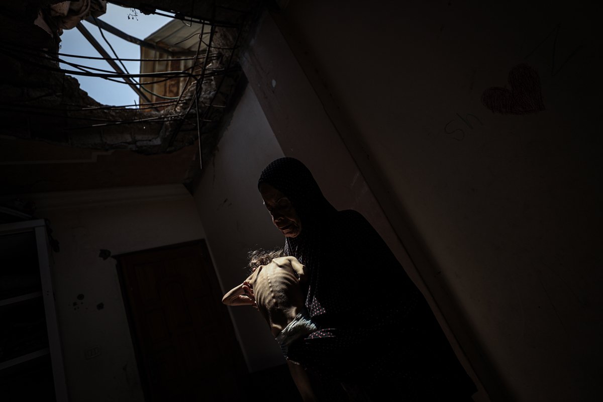 Gazze'de çocukların açlıkla imtihanı