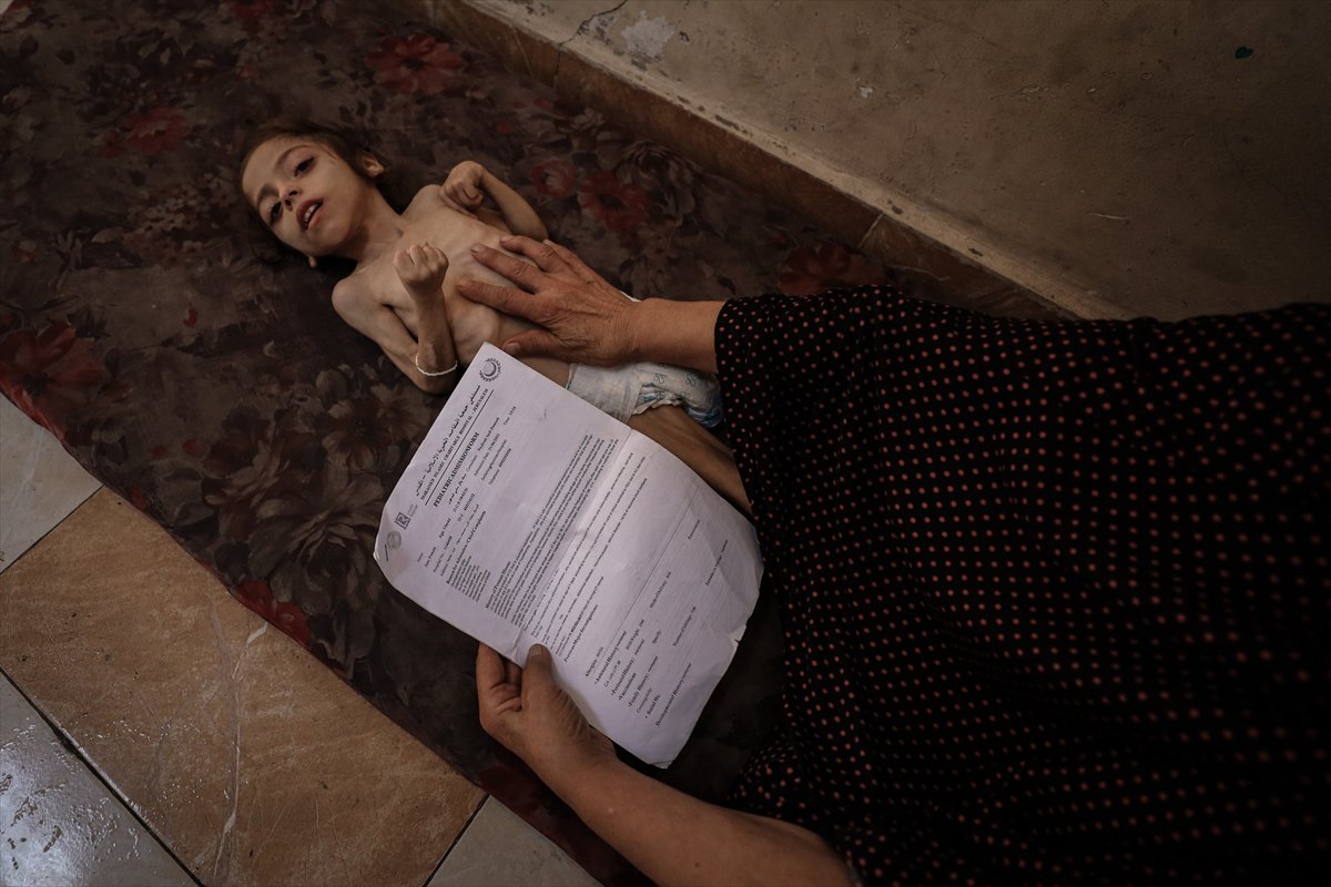 Gazze'de çocukların açlıkla imtihanı