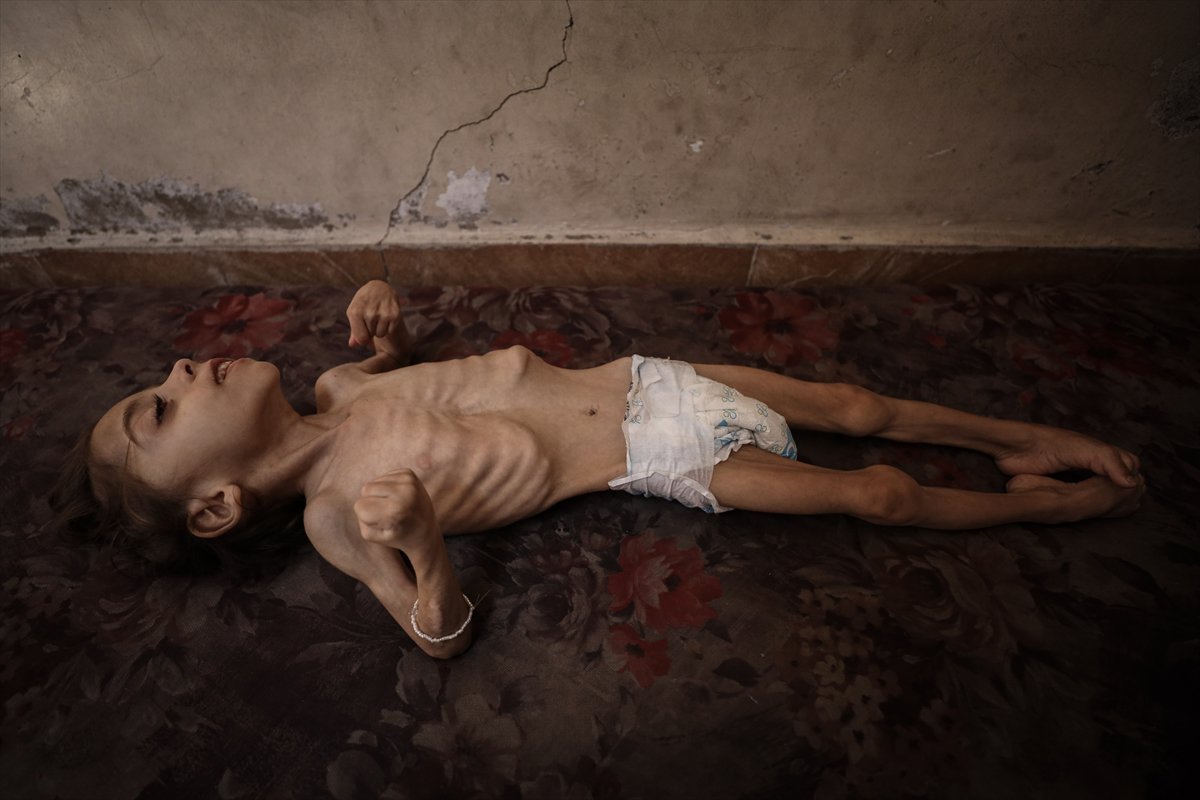 Gazze'de çocukların açlıkla imtihanı