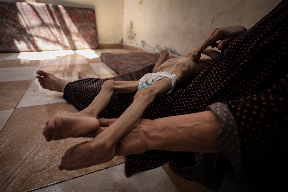 Gazze'de çocukların açlıkla imtihanı