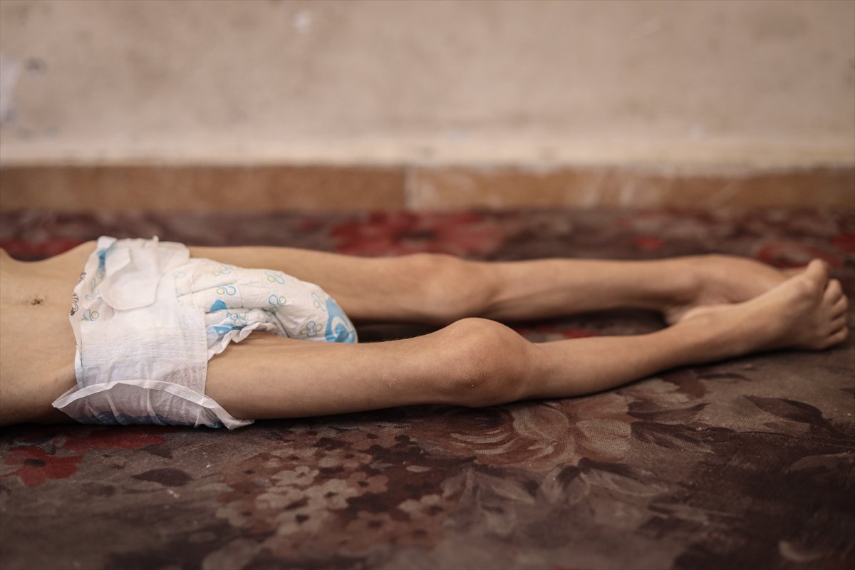 Gazze'de çocukların açlıkla imtihanı