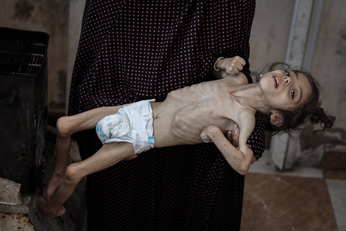 Gazze'de çocukların açlıkla imtihanı