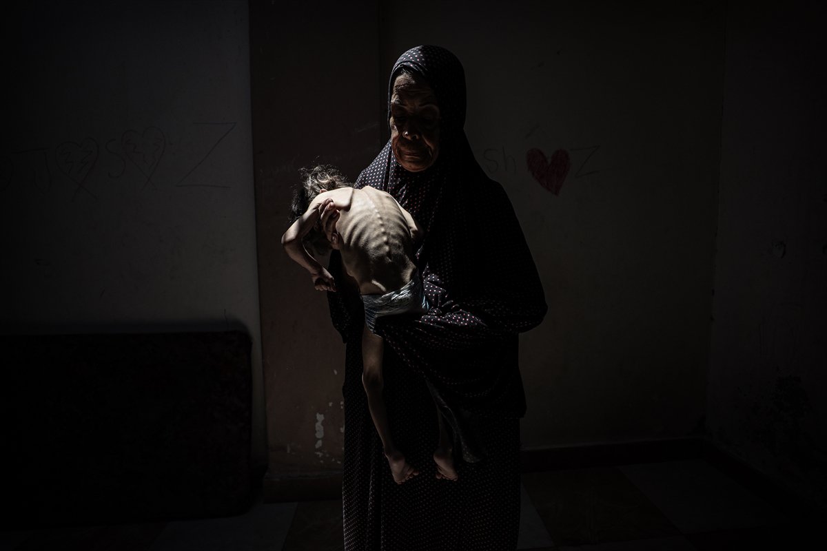 Gazze'de çocukların açlıkla imtihanı