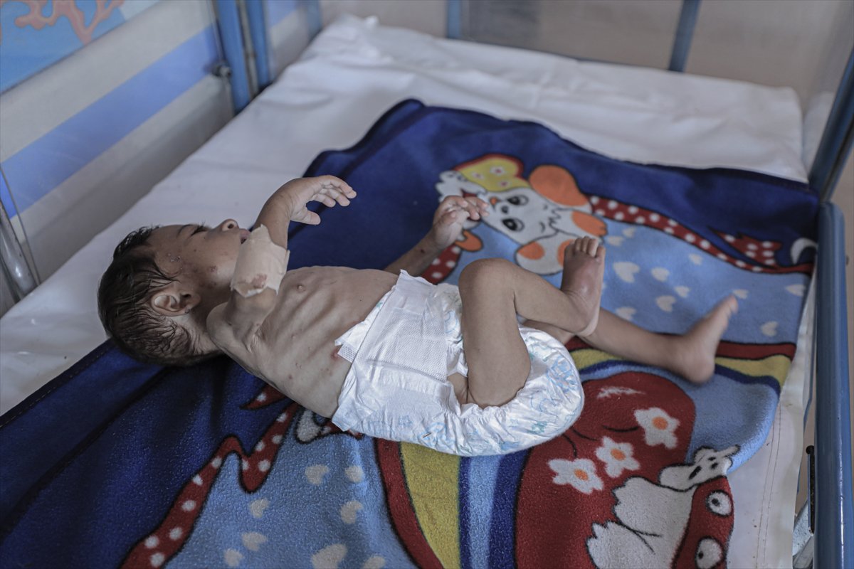 Gazze'de çocuklar ve bebekler açlıkla mücadele ediyor