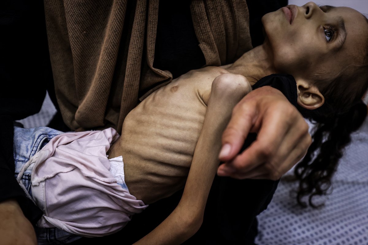 Gazze'de çocuklar ve bebekler açlıkla mücadele ediyor