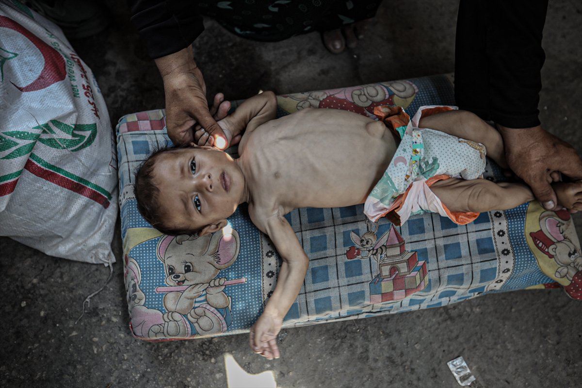 Gazze'de çocuklar ve bebekler açlıkla mücadele ediyor