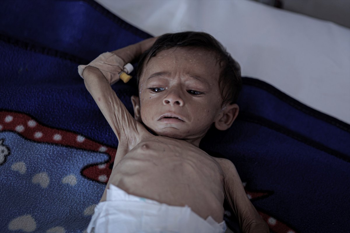Gazze'de çocuklar ve bebekler açlıkla mücadele ediyor