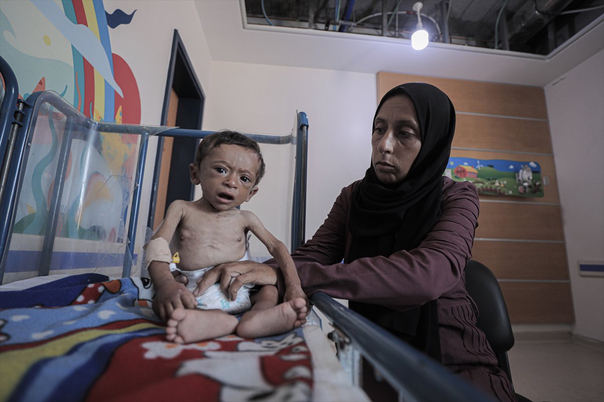 Gazze'de çocuklar ve bebekler açlıkla mücadele ediyor