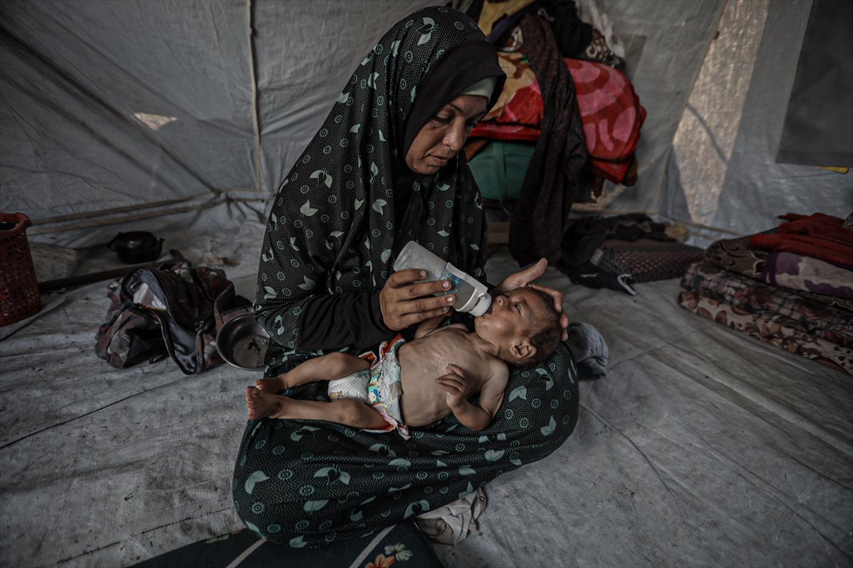 Gazze'de çocuklar ve bebekler açlıkla mücadele ediyor