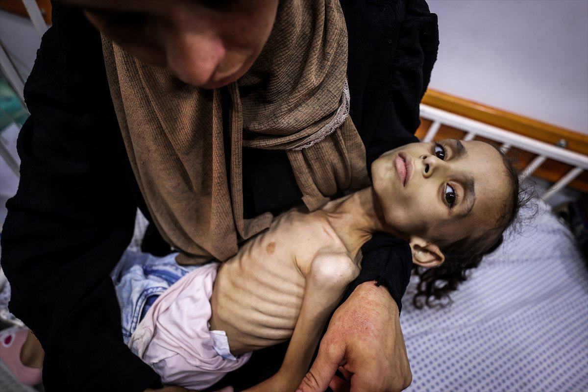 Gazze'de çocuklar ve bebekler açlıkla mücadele ediyor