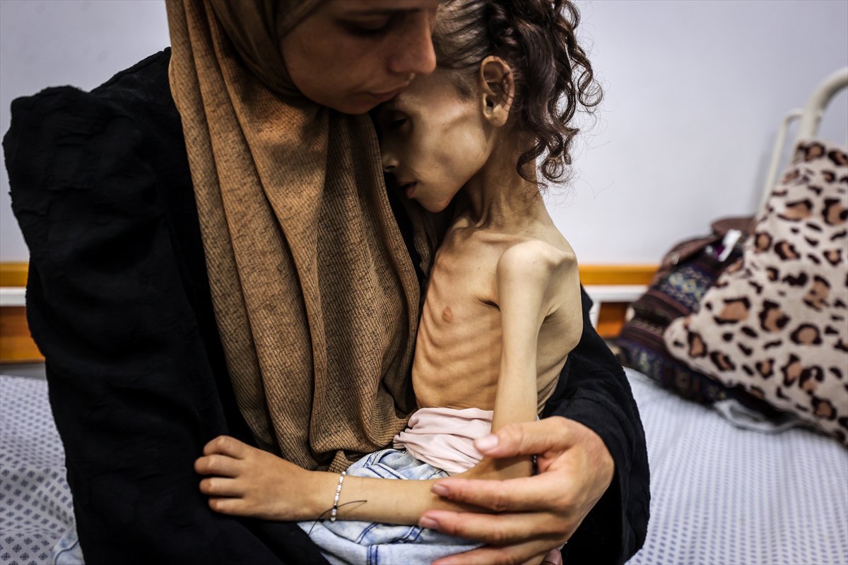 Gazze'de çocuklar ve bebekler açlıkla mücadele ediyor