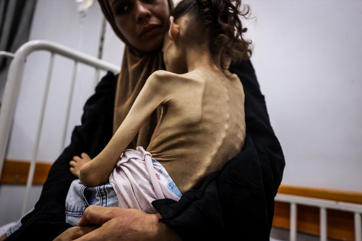 Gazze'de çocuklar ve bebekler açlıkla mücadele ediyor