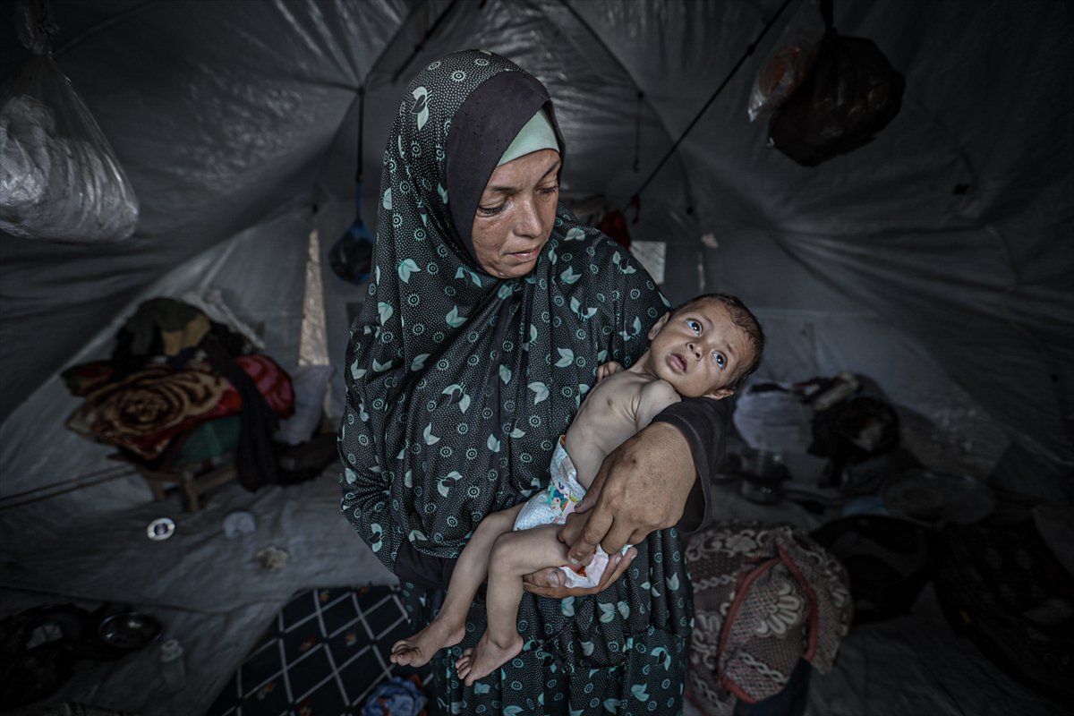Gazze'de çocuklar ve bebekler açlıkla mücadele ediyor