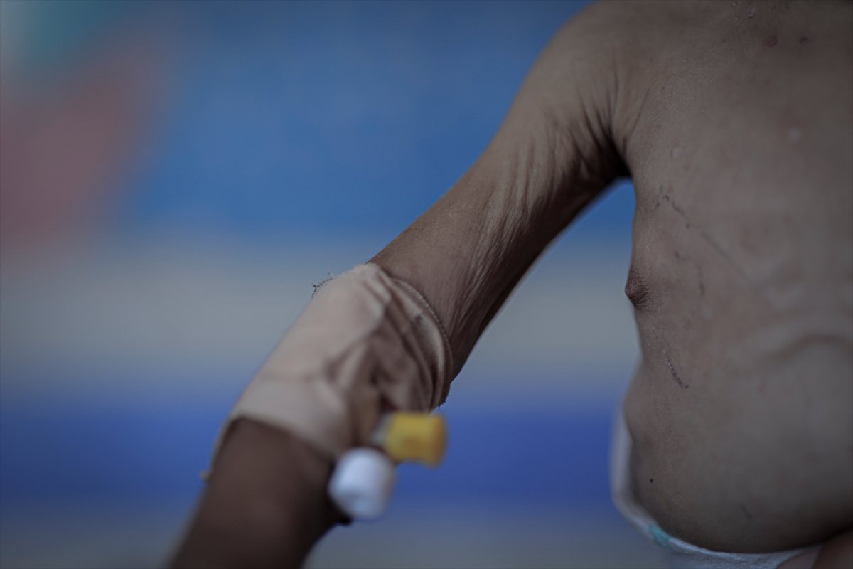 Gazze'de çocuklar ve bebekler açlıkla mücadele ediyor