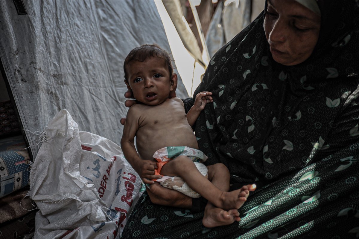 Gazze'de çocuklar ve bebekler açlıkla mücadele ediyor