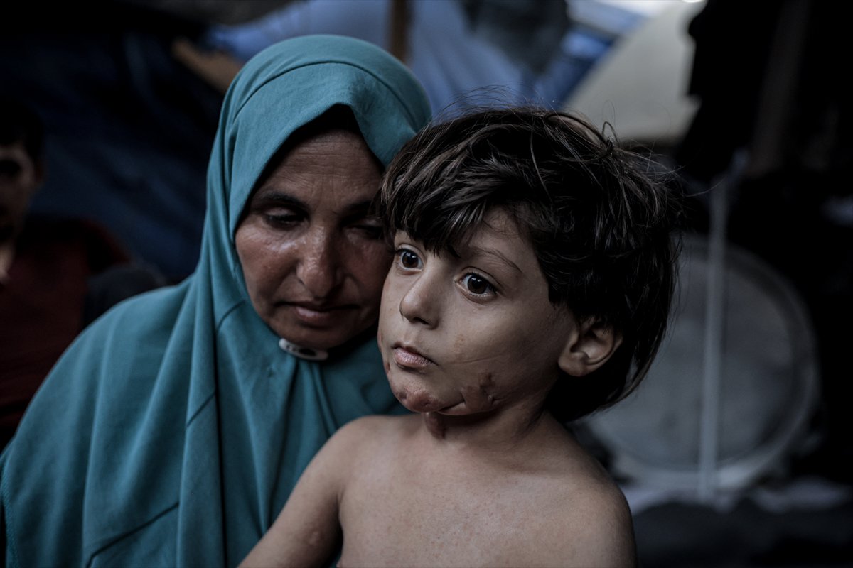 İsrail saldırısının hedefi olan çocuklardan biri: Muhammed